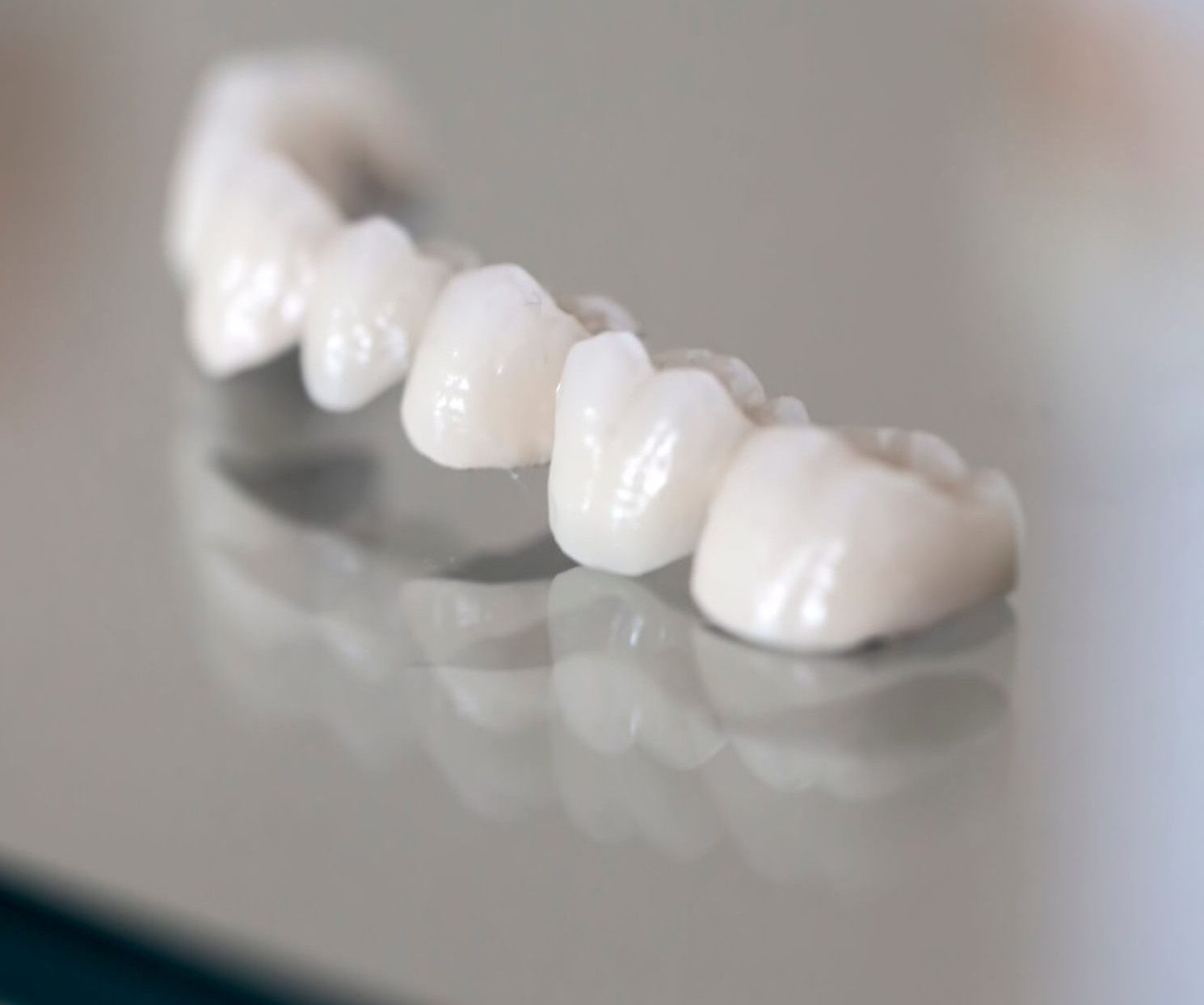 Picture of a dental crown.